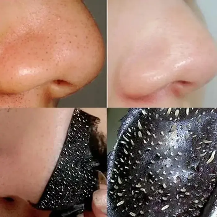Masque anti-points noirs
