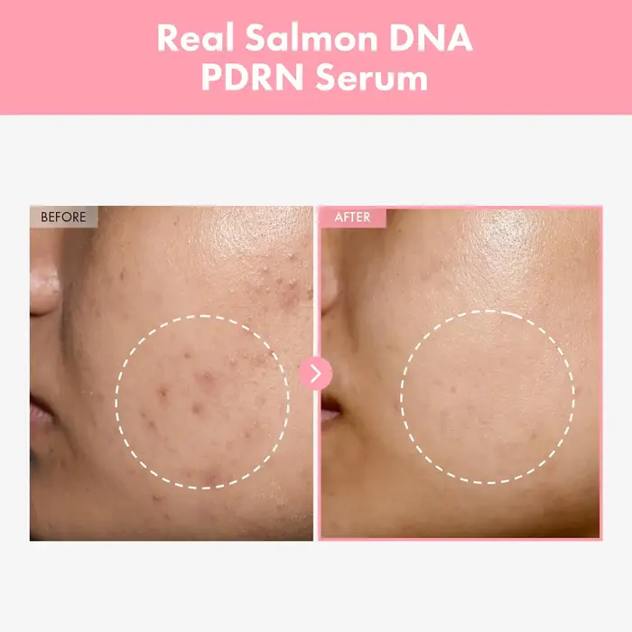 Soin du visage E-s-s-e-n-c-e Peau délicate et hydratante. Colagène hydrolysé au peptide rose pdrn