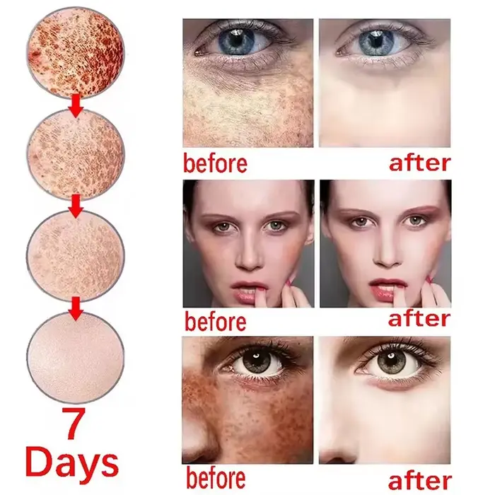 Crème blanchissante pour le visage