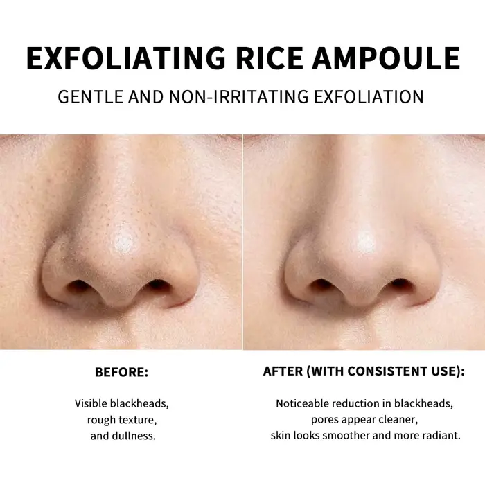 Ampoule Exfoliante au Riz : Effet Éclatant