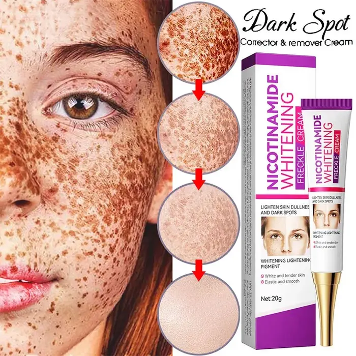 Crème éclaircissante au Melasma Niacinamide douce