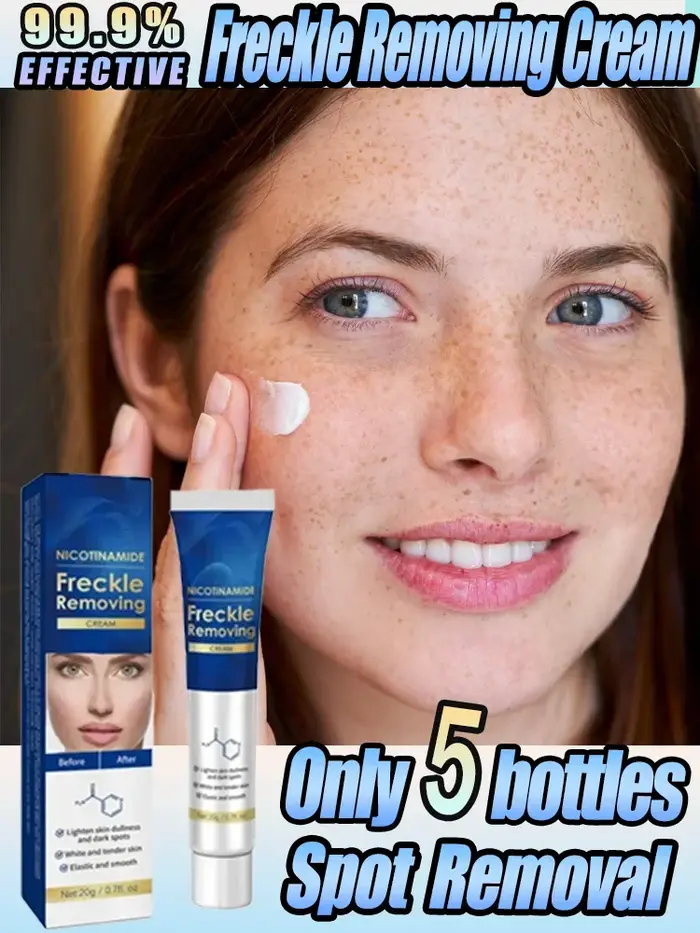 Crème anti-taches foncées efficace pour le visage, élimination des taches de rousseur, des mélasmes, des plaques de soleil, des taches de rousseur
