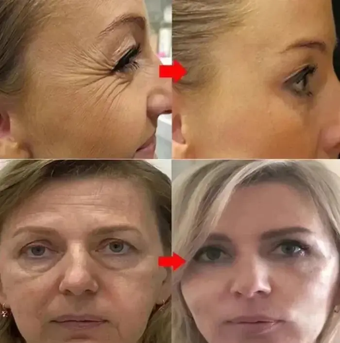 Sérum rétinol pour le visage