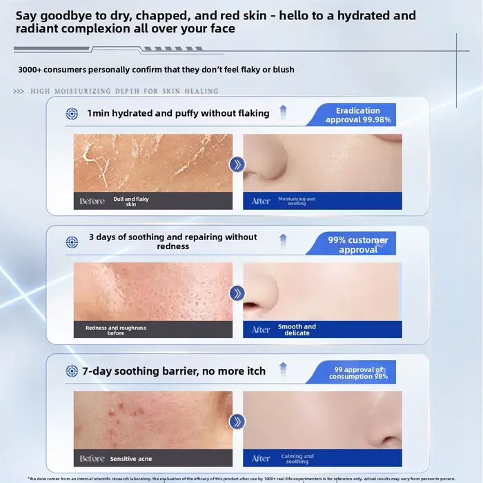 Crème visage RUYI B5 ​ Verrouillage d'hydratation profonde Rougeur apaisant hydratant ​ Protection de barrière ​ Soins