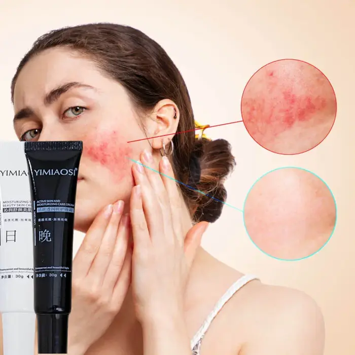Crème Réparatrice Anti-Rougeurs Visage – Améliore la Peau Sensible et la Sécheresse – Lotion Hydratante Apaisante – Élimine la Rosacée – Jour et Nuit – Cosmétiques Coréens