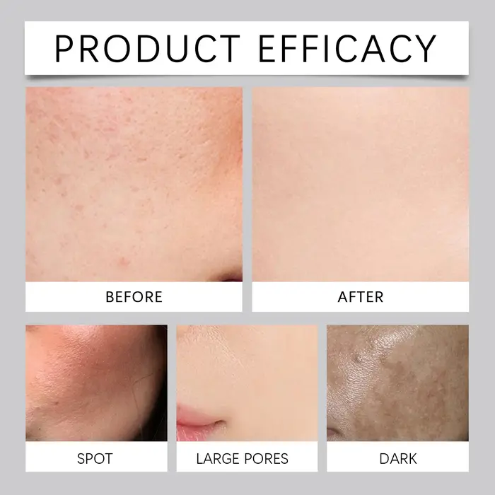 Poudre Nettoyante Enzymatique pour le Visage – Contrôle du Sébum