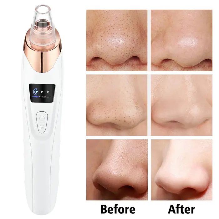 Dissolvant de points noirs pour le nettoyage du visage, machine de beauté à 3 modes d'aspiration, di