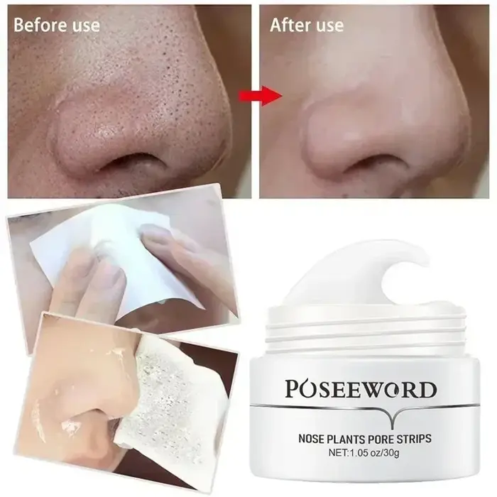 Dissolvant de points noirs efficace