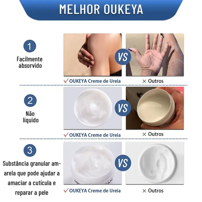 Crème Corporelle à 40% d'Urée