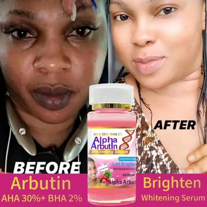 120 ml SUPER AHA 30% + BHA2% Alpha Arbutin X 3 sérum visage éclaircissant au lait avec la glutathion