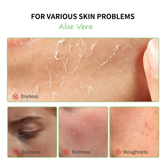 Gel d'aloe vera éclaircissant