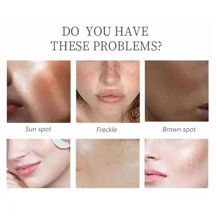 Crème hydratante à l'acide kojique et au collagène pour le visage