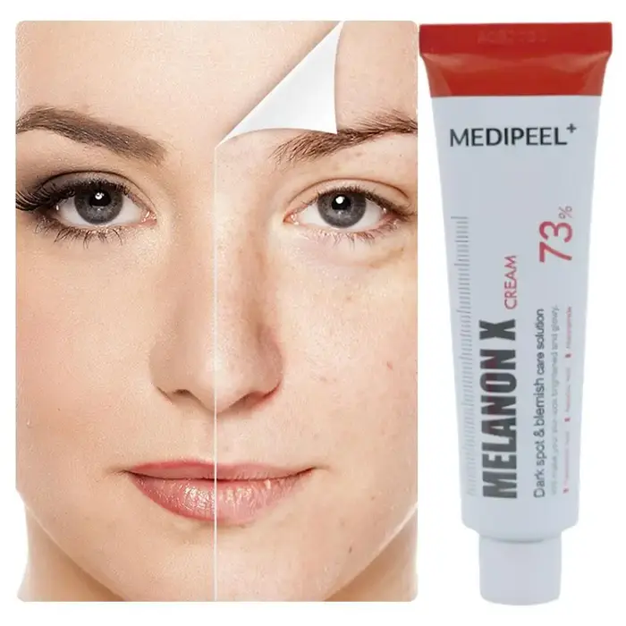 Crème anti-acné hydratante 30ml