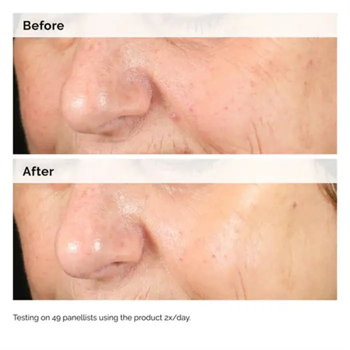 Alpha Arbutin 2% + HA 30ml Sérum Minimise L'apparence des Taches Foncés et Décoloration Hydrate La Peau