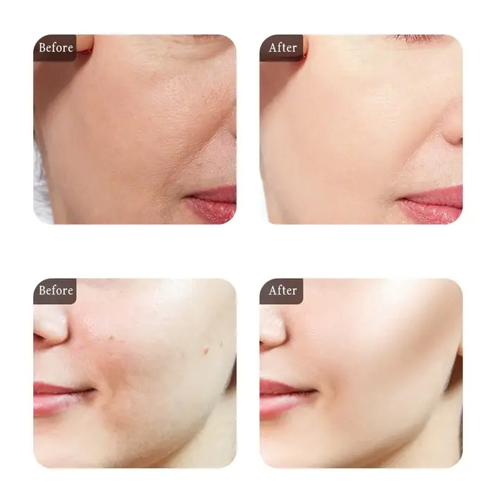 Sérum et crème hydratante pour le visage