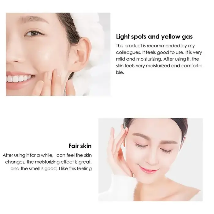Crème blanchissante anti-taches de rousseur pour le visage