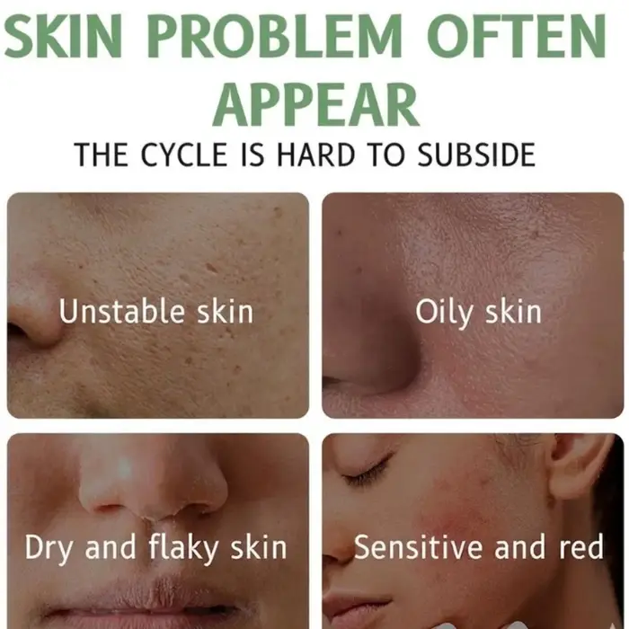 Crème pour le visage à la Centella Asiatica, réparatrice de la barrière cutanée à la céramide, hydratante pour les peaux sensibles sujettes à l'acné, crème de nuit apaisante et hydratante