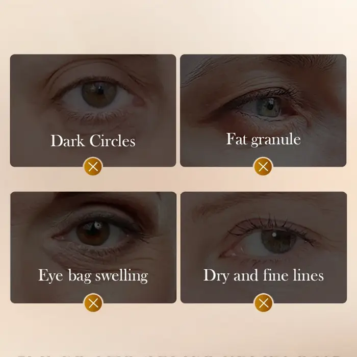 Crème pour les yeux anti-rides SADOER au peptide de venin de serpent et à la caféine