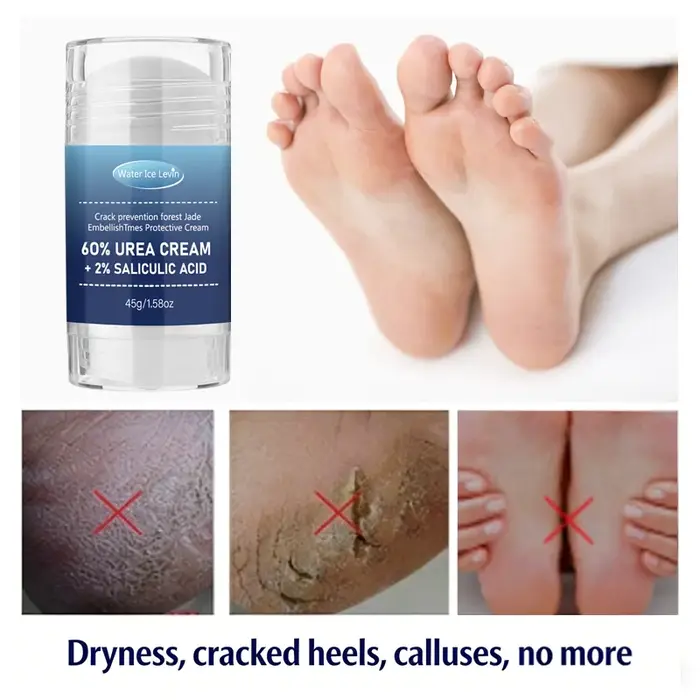 Crème pour les Pieds à 60% d'Urée