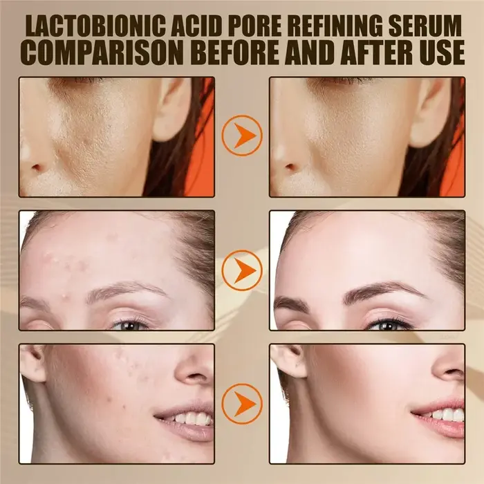 EELHOE acide lactobionique rétrécit les pores sérum pour le visage réparation de la peau points noirs propres acné soins