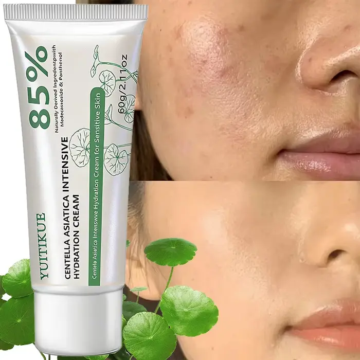Crème YUITIKUE à la Centella Asiatica 85% Hydratation Intensive Réparatrice pour Peaux Sensibles avec Panthénol 60g
