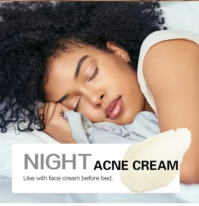 Crème pour le visage éclaircissante au curcuma naturel AILKE, boostant l'éclat, hydratant pour la peau, crème anti-acné pour le visage, pour tous les tons de peau