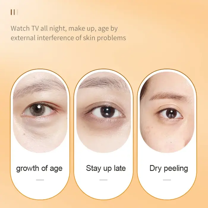 SADOER vitamine C crème pour les yeux raffermissant hydratant éclaircissant Anti cernes sacs