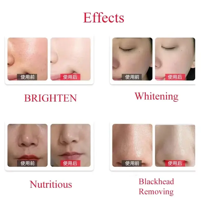 Solution professionnelle dermabrasion
