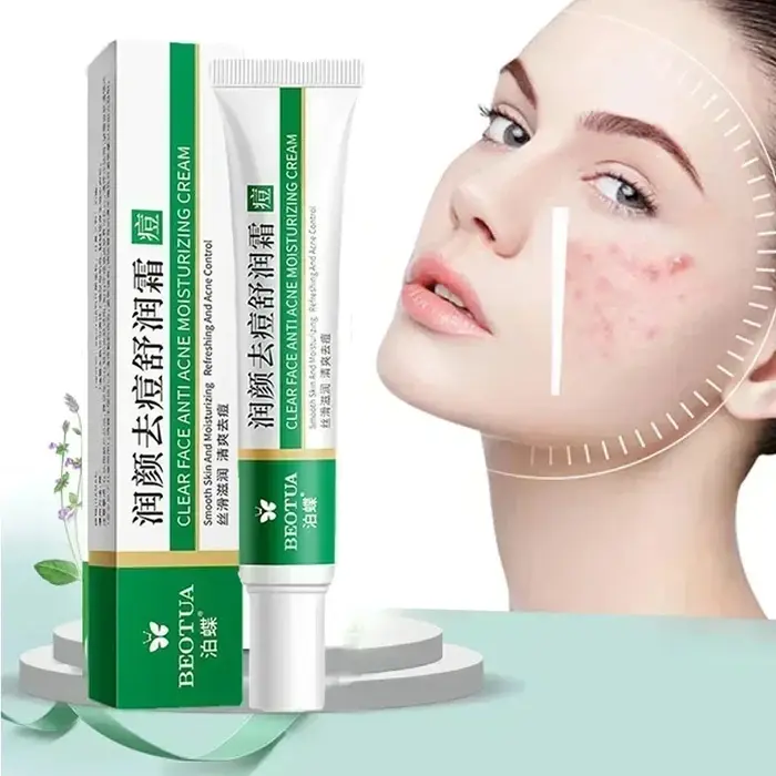 Crème de traitement de l'acné à base de plantes, dissolvant de cicatrices du visage, Gel réparateur,