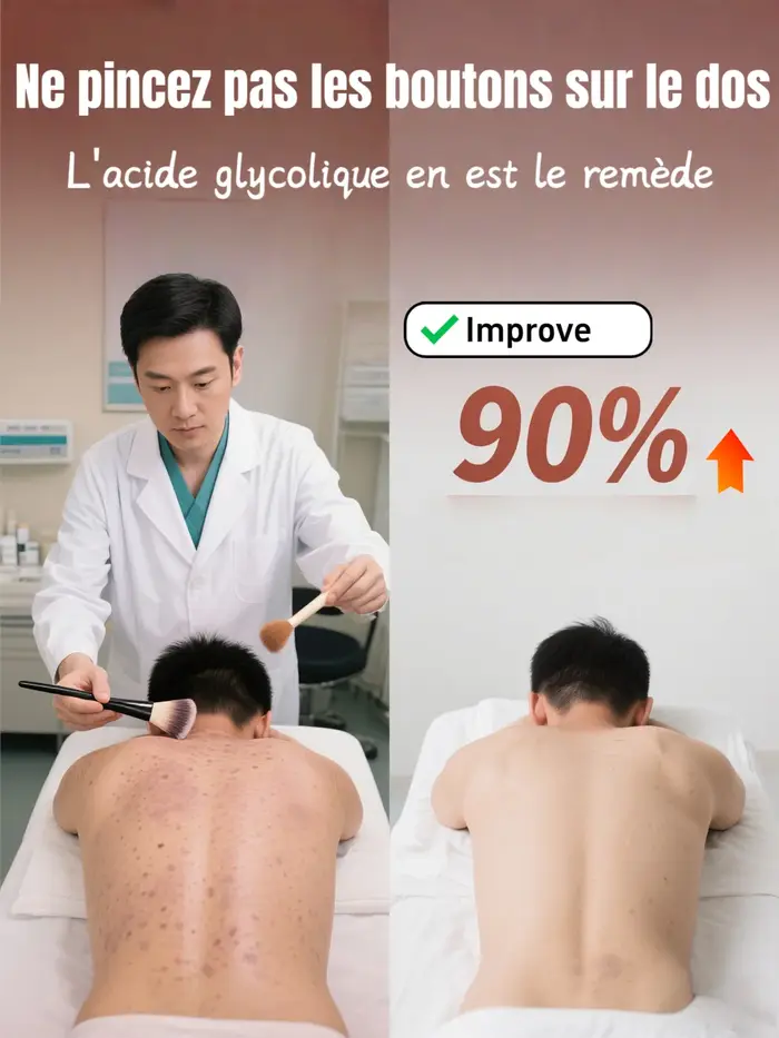 Peeling chimique à l'acide glycolique