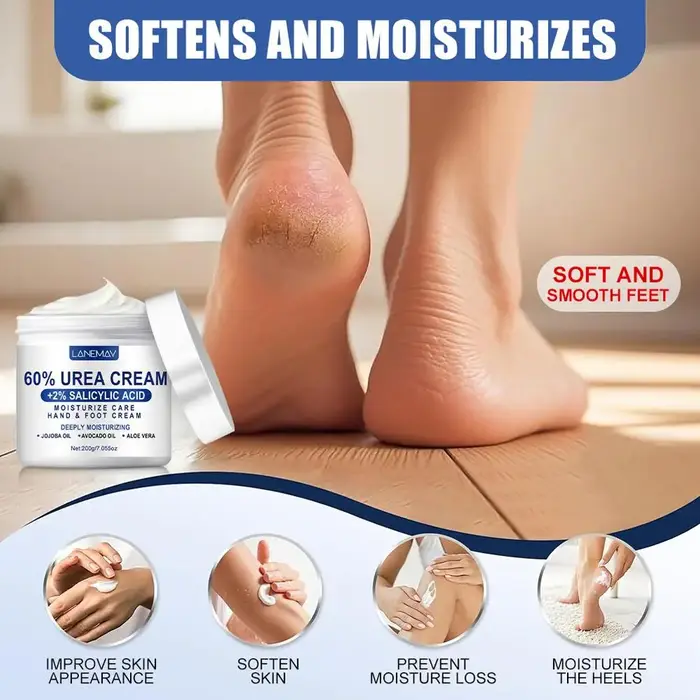 Crème à l'urée 60% et acide salicylique 2%, crème pour les pieds secs et gercés, talons, genoux, coudes, mains, crème hydratante pour les mains et les pieds 200g