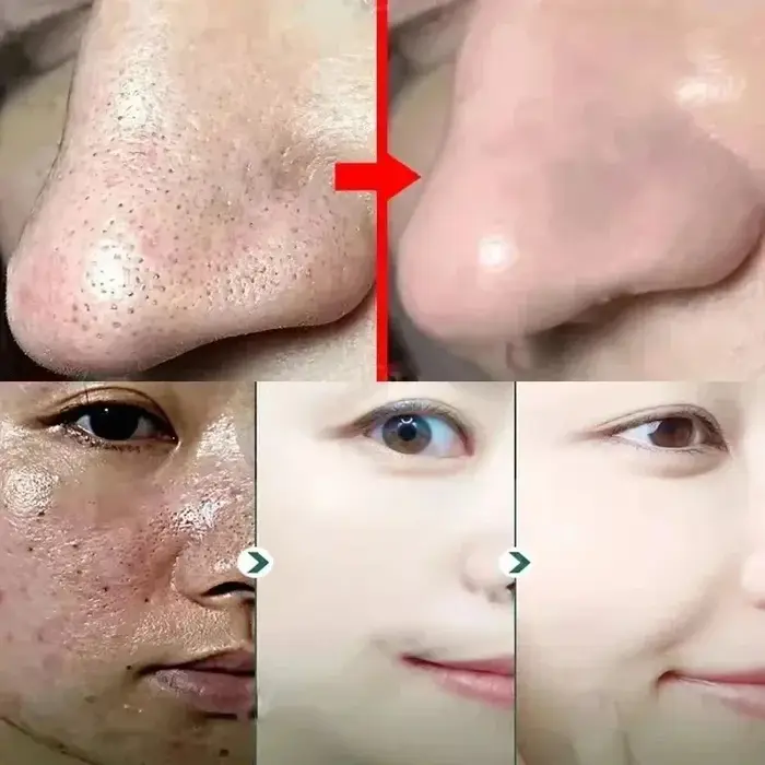 Masque rétrécissement des pores à l'acide salicylique