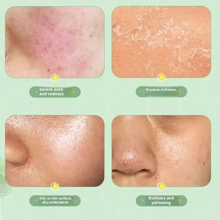 Gel hydratant à l'aloe vera pour le visage