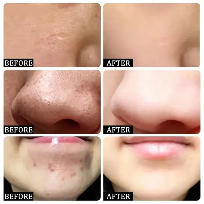 Sérum Coréen Resserre les Pores