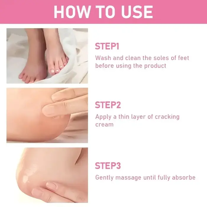 Crème à 60% d'urée + 2% d'acide salicylique pour les pieds et les mains, anti-dessèchement, élimination des peaux mortes, hydratante, parfumée, élimine les odeurs de pieds