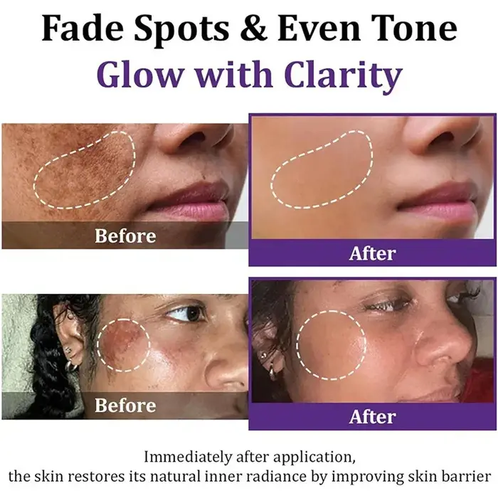 Crème éclaircissante pour le visage