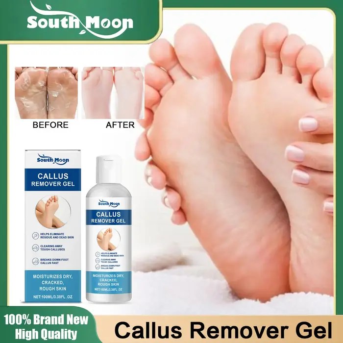 Gel dissolvant de callosités des pieds