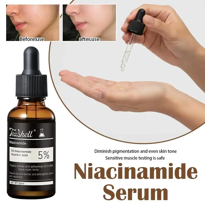 Sérum à la niacinamide 5% 30 ml, essence éclaircissante pour le visage, pour les peaux sujettes à l'