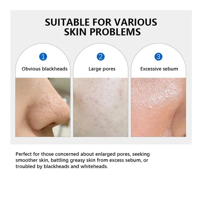 Lakerain – Lot de 2 produits de soin : Tampon tonifiant 0-Pore, Sérum éclat au peptide rose et ADN de saumon, Hydratant purifiant au beurre de karité