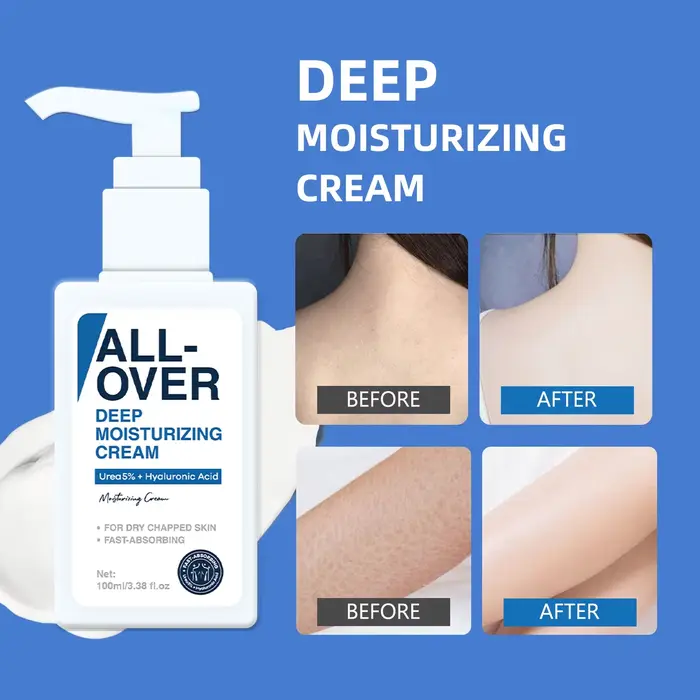 ALL-OVER crème hydratante en profondeur 100ml 5% urée acide hyaluronique hydratation peau sèche gercée Absorption rapide visage corps soins des mains