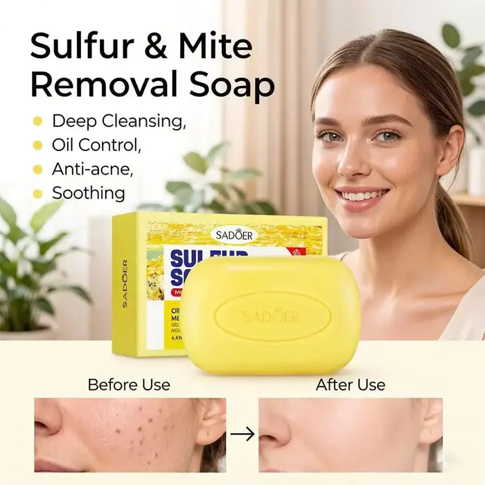 Savon Nettoyant au Soufre pour Visage et Corps – Anti-Acné