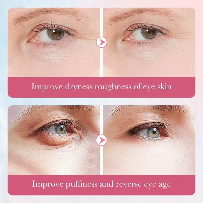 Crème pour les yeux au collagène Sakura SADOER - En stock