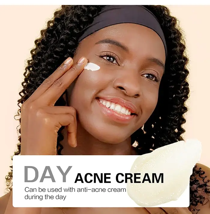 Crème pour le visage éclaircissante au curcuma naturel AILKE, boostant l'éclat, hydratant pour la peau, crème anti-acné pour le visage, pour tous les tons de peau