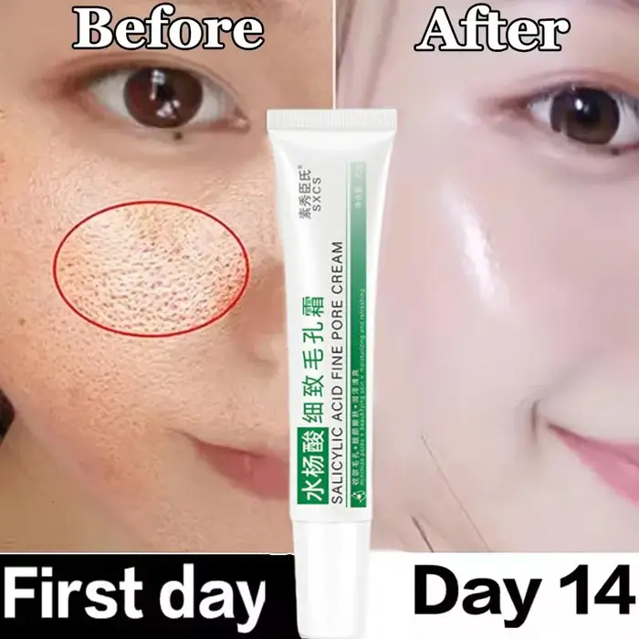 Crème Nettoyante pour les Pores à l'Acide Salicylique
