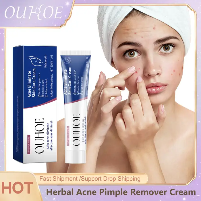 Crème de traitement de l'acné pour le visage