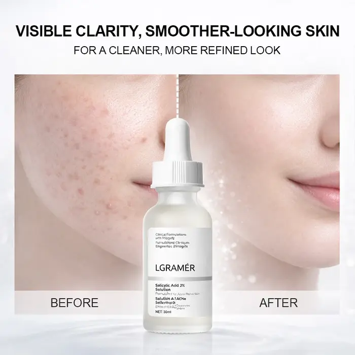 Essence faciale à l'acide salicylique à 2 %