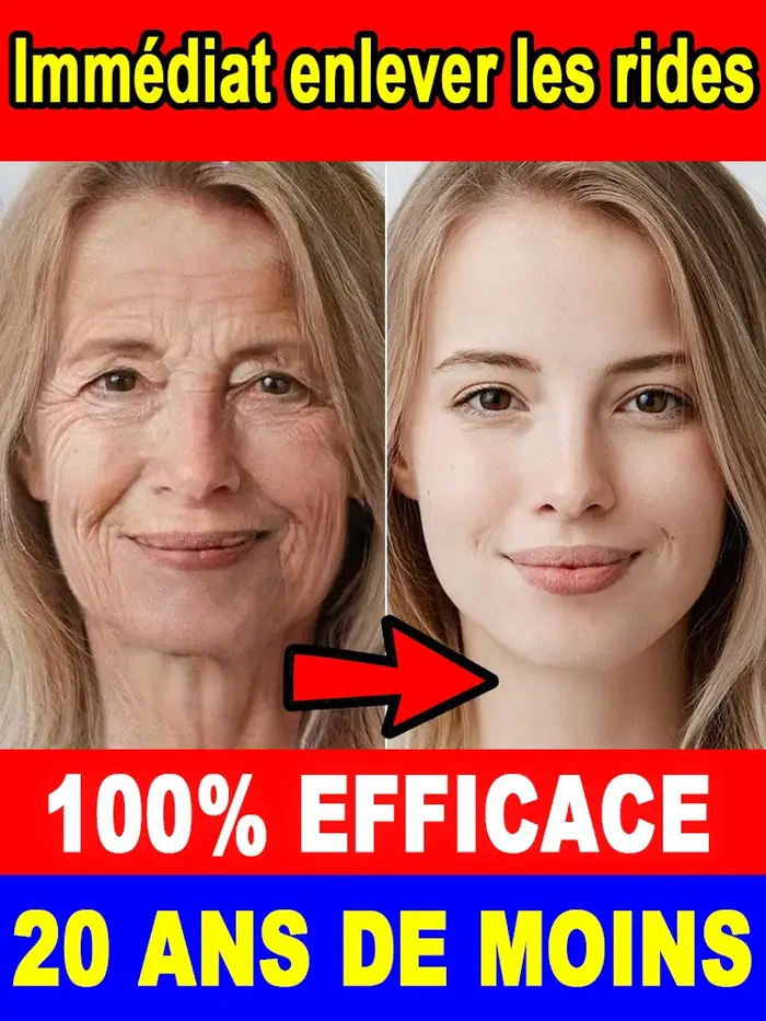 20 ans plus jeunes, pas de ridules
