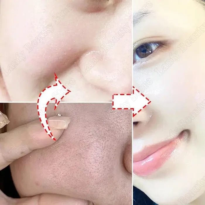 Crème de nettoyage des pores à l'acide salicVAC