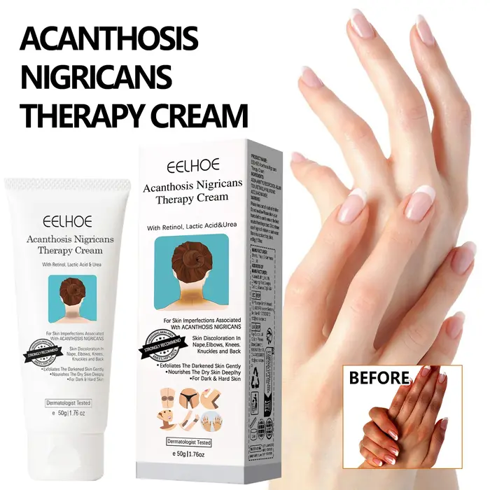Crème blanchissante éclaircissante pour la peau foncée