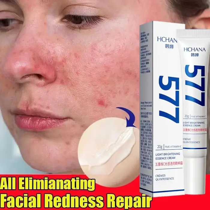 Crème Réparatrice Anti-Rougeurs Visage – Améliore la Peau Sensible et la Sécheresse – Hydratant Apaisant – Élimine la Rosacée – Cosmétiques Coréens